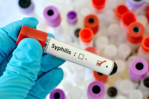 siphilis
